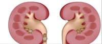 Kidney damage Sign: These signs seen on the body along with hands and feet in the morning